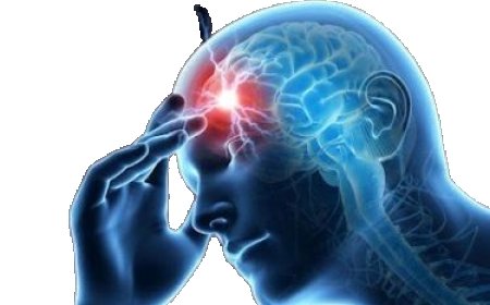 Is Brufen 200mg Strong Enough for Severe Pain?