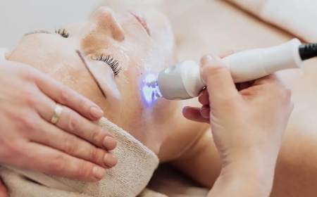 Laser Skin Treatment in Beverly Hills: A Luxurious Path to Radiant Skin