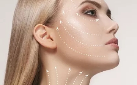 What Makes the Best Doctors in Dubai the Right Choice for Profhilo Treatments