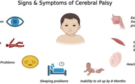 Managing Cerebral Palsy Symptoms with Muscle Relaxant Baclofen