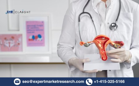 Uterine Fibroid Treatment Devices Market Size & Forecast 2034