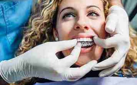 Gum and Orthodontics: Can You Chew It with Braces or Aligners?